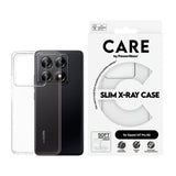 Xiaomi 14T Pro - CARE by PanzerGlass FASHION X-Ray Soft Basic Cover - Gjennomsiktig